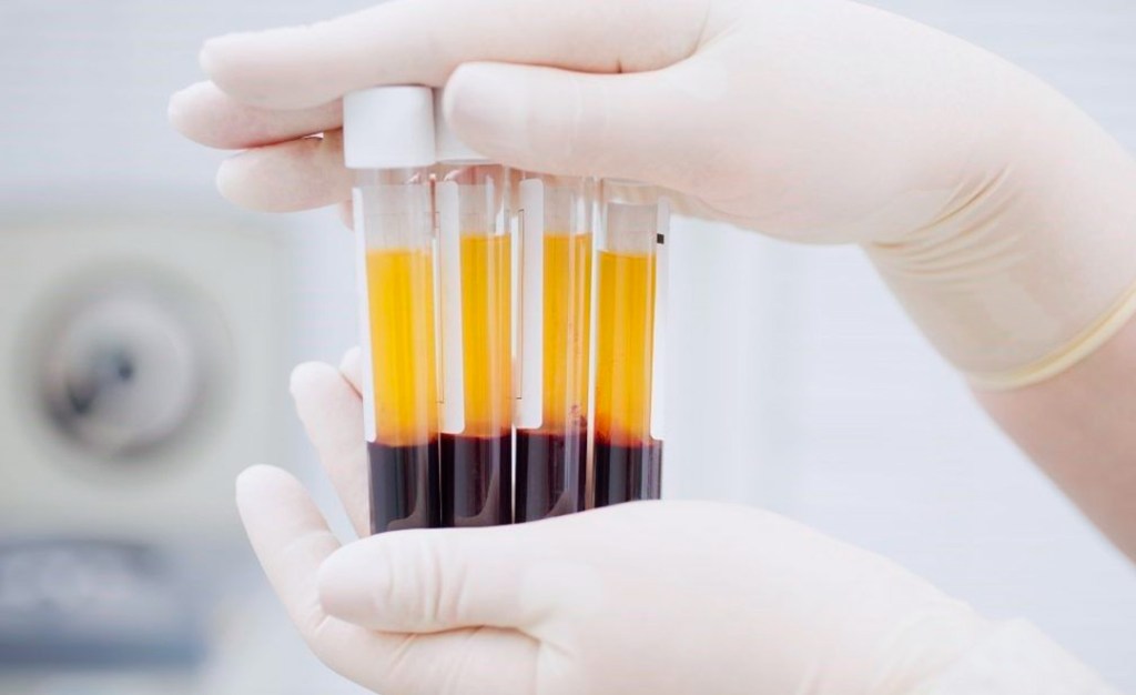 Plasma Rico en Plaquetas o Skin Boosters: ¿Cuál conviene&nbsp;más?